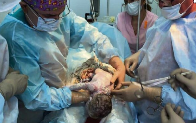 C-Section Performed in ‘Shining Star’ Hospital in Ukraine